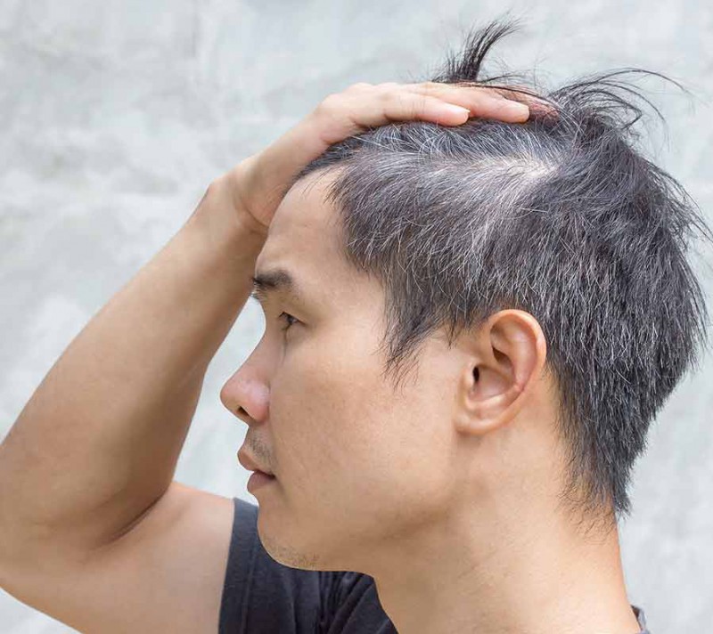 nguoi tre bi toc bac anh 6